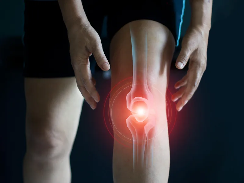 How Strong Roots Chiropractic treats arthritis in Eureka
